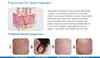 Hot Sale Scar Removal Skin Tighten Fractional Laser Fractional Co2 Laser Machine