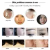 Bärbar laser Picosecond Pen Tatuering Freckle Removal Mole Dark Spot Pigment Remover Anti Aging Freckle Tatuering Borttagning Lasermaskin för hem