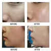 Laser koolstofcrème zwarte poppen poriën reiniger diepe reiniging modder gezicht masker masker verwijdering peeling gel huid Verjonging 80 ml5153472