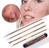 4 stks Acne Tweezer Comedo Machine Set Removal Pimple Needle Blackhead Remover Black Head Extractor Comedone Tool voor Lady Gratis verzending