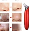 Gezicht huidverzorging pore reiniging vacuüm mantel remover acne puistje verwijdering schoonheid gezonde zuiggereedschap derm schuring machine diamant dermabra