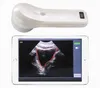 Draadloze Mini Ultrasound Scanner met afbeelding in Smart Phone / Tablet via WiFi Transferr ingebouwde en vervangbare batterij