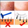 Удаление волос для лица легко удалить волоски на верхней части губного подбородка щеки эпилярную депилятор по депиляции бритья