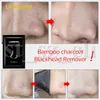 LANBENA Black Mask Face Care Mask Cleaning Tearing Style Pore Strip Deep Cleansing Nose Acne Blackhead Remover Facial Mask