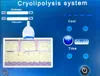 Cryo dubbele kin vetvries draagbare cryolipolyse machine thuis met 2 handvatten