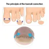 6PCS Ingrown palca korekta paznokci Piaser Pedicure Pedicure ParonyChia Odzyskiwanie korektora paznokci pielęgnacji stóp narzędzie