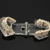 Modello dei denti per la malattia dell'impianto dentale con il dentista del dente del ponte di restauro per lo studio di insegnamento delle malattie dentali di scienze mediche268s