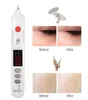 Laser Plasma Pen Liquid Crystal Skin Care Tool Mole Tattoo Freckle Wart Label Removal Pens Spot Tool Facial Beauty Machine