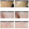 Корея Derma Make Titanium Microneedle с микроиголькой Dermastamp Micro Игла-аппликатор Стеклянная бутылка для инъекций сыворотки на кожу