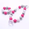 Hot Pink + Grau Farbe Chunky NecklaceBracelet Set Mode Anhänger Perlen Kinder Mädchen Bubblegum Chunky Bead Halskette Schmuck-Set