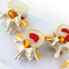 Freeshipping Human Anatomy Skeleton Spine 4-Stages Lumbar Vertebral Model Brain Skull Traumatic Teaching Supplies