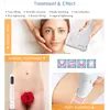 3 in 1 vaginal hifu beauty machine face lifting skin rejuvenation device body slimming beauty salon equipment