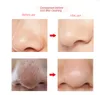 Facial Blackhead Remover Face Nose Acne Black Dot Pimple Electric Blackhead Remover Cleaner Pore Blackhead Sucking Skin Tools