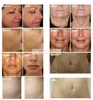 Przenośne 4 Porady Frakcyjne Micleedle RF Maszyna do podnoszenia skóry Facial Stretch Mark Acne Usuwanie Skincare Odmładzanie radiowe Częstotliwość