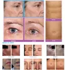 التردد الراديوي microneedling fractional rf maceial macher marks إزالة الجلد تشديد التجاعيد تقليل microneedle مضادة للشيخوخة إزالة ندوب حب الشباب