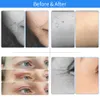 Maglev Plasma pen Wrinkle Eyelid Lift Plasmapen Mole Removal Pen Spot Tattoo Freckle