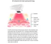 顔リフトのセリウムのための高輝度集束超音波アンチの反転を細くするプロの4D Hifu Machine 12ライン20000ショット本体