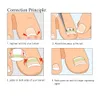 Herramientas de corrección de pedicura para uñas encarnadas, Clip alisador, parche para uñas, lima de uñas, pegamento, herramientas para el cuidado de los pies, 3 uds.