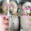 Laser Freckle Removal Machine Hudfläckborttagning Mörka fläckborttagningsmedel för ansiktet Vårta Tag Tatuering Borttagning Pen Salon Hem Skönhetsvård