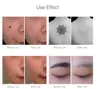 Penna laser professionale a picosecondi BlueRed Rimuovi la penna laser del tatuaggio Lentiggine Acne Talpa Macchina per la rimozione del tatuaggio del pigmento del punto scuro3329