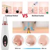 Poderoso Blackhead Remover Acne Aspirador de Pó Preto Face principal Skin Care Extractor Pore Nose sucção Massagem Remoção Facial