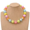 Rood Hart Charms Hars Bubblegum Kralen Ketting Armbanden voor Kinderen Meisjes Multistyle Veel Type voor Kiezen