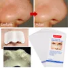 Zwarte Dots Masker Neus Strip Blackhead Remover Nasal Sticker Bladmasker voor Gezicht Black Head Neus Diepe Reiniging Huidverzorging 3000 PC's / partij DHL