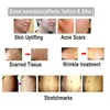 Ersatz Mikronadel -Patronen -Tipps für automatische Derma Stempel wiederaufladbarer drahtloser Drahtlosen A6 Derma Pen Hautpflege Anti -Spot Scar Re2188172