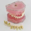 Soral Dental Implant Teeth Model Study Lär standardmodell med avtagbara tänder269j