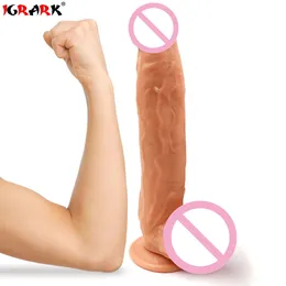 IGRARK Süper Uzun Büyük Büyük Yapay Penis 11.8 Inç 30 cm Anal Kadın Penis Gerçekçi Dev Vantuz Için Seksi Oyuncaklar
