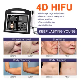 4D HIFU Anti-Aging Ultraljudsbehandling Ansiktsbehandling 12 Linjer 20000 SHOTS VAGINAL ÅTGÄRDSKYDD