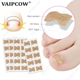 10pcs Ingrown 발톱 교정기 스티커 Paronychia 치료 회복 보정기 페디큐어 도구 손톱 발가락 네일 케어