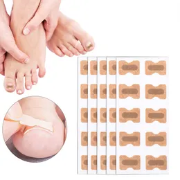 100pcs/conjunto adesivos de correção de unhas encravadas corretor de corretor patches paronychia Recuperem ferramentas de pedicure corretor