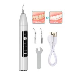 Blanchiment des dents sonique, nettoyage dentaire, dissolvant de calcul, taches de tartre, miroir buccal, nettoyeur de dents électrique, blanchisseur pour adultes