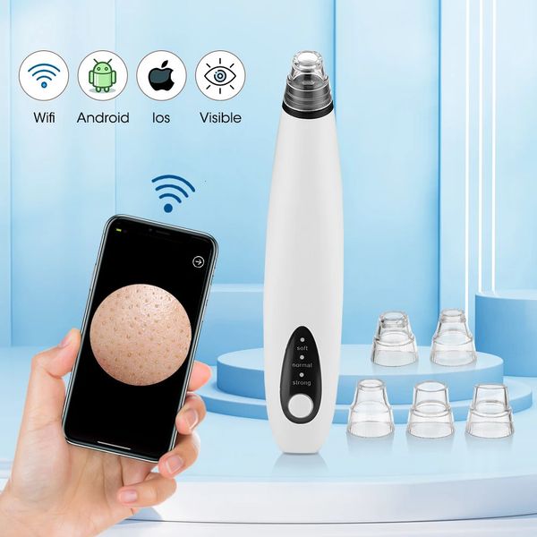 Cámara WiFi Visual Face Blackhead Remover Aspiración por vacío Limpiador de poros Limpieza de nariz profunda Eliminación de espinillas con 5 cabezales Herramienta 240106