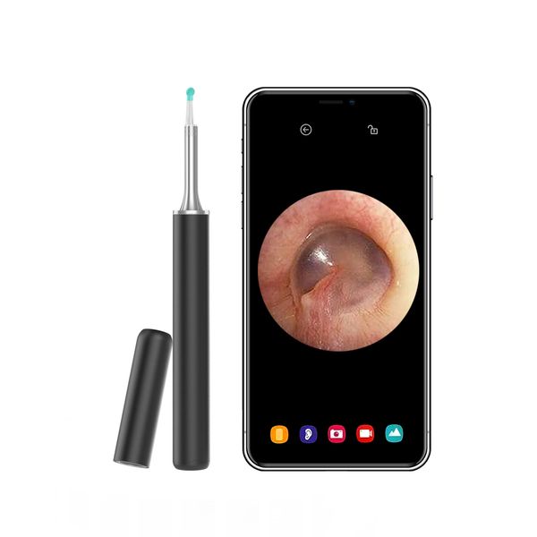 Otoscopio Visual inalámbrico para oído, cámara HD para inspección Oral, luz LED, endoscopio de oído Wifi, boroscopio para el cuidado del oído