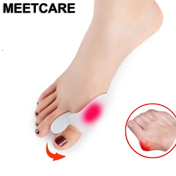 Cuidado de los pies de las mujeres Hallux Valgus One Ring Big Toe Small Toe Ortopédicos Correct Daily Silicone Toes Small Bone Foot Care Soft